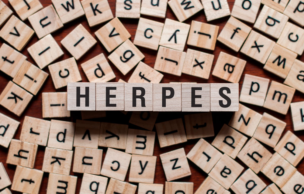 Herpes genitalis - herpes på kønsdelene.
